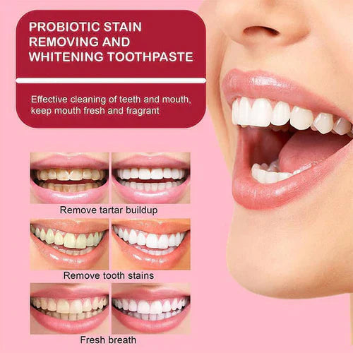🔥2025 HOT SALE🔥 JEREMYTIS™ Probiotic Whitening Toothpaste