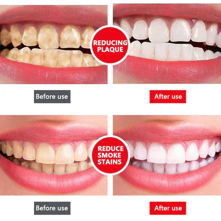 🔥2025 HOT SALE🔥 JEREMYTIS™ Probiotic Whitening Toothpaste