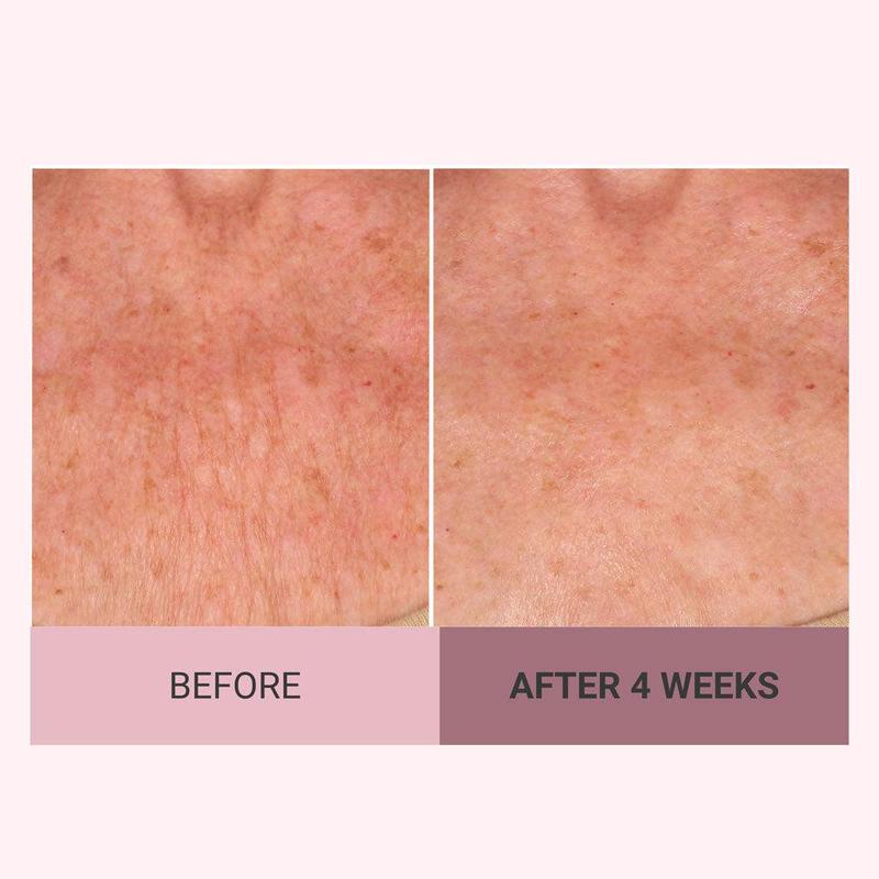 💆♀️ Experience Ultimate Luxury - 50% OFF - ✨ Champagne Beaute Lift Firming Body Cream - For Firmer, Smoother, Radiant Skin! 🌟(Buy 3 & Free Shipping)