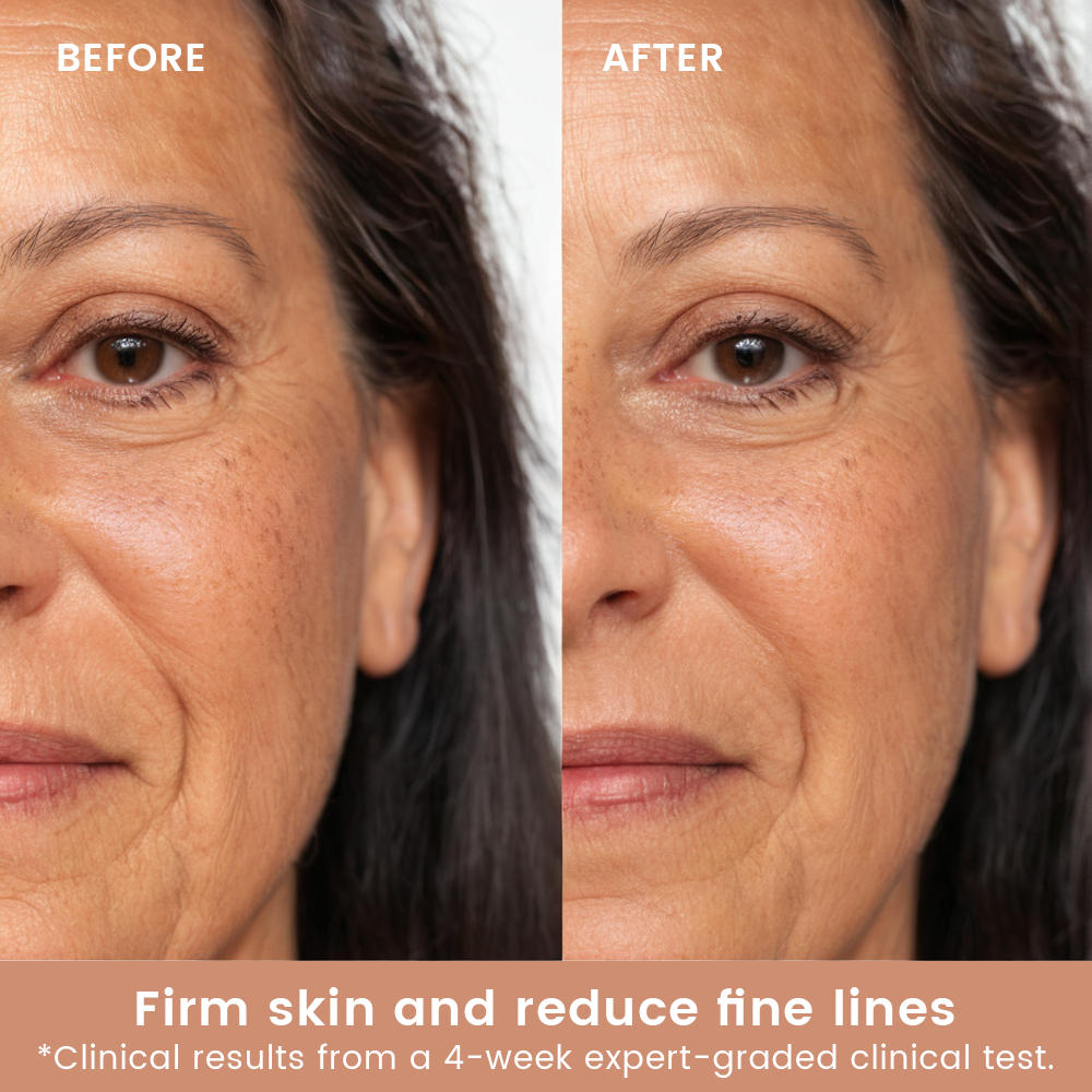 Seurico PHA Serum
