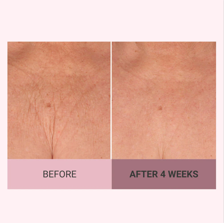 💆♀️ Experience Ultimate Luxury - 50% OFF - ✨ Champagne Beaute Lift Firming Body Cream - For Firmer, Smoother, Radiant Skin! 🌟(Buy 3 & Free Shipping)