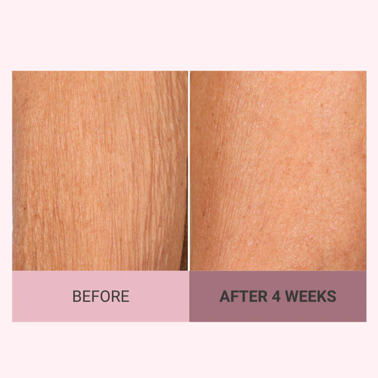 💆♀️ Experience Ultimate Luxury - 50% OFF - ✨ Champagne Beaute Lift Firming Body Cream - For Firmer, Smoother, Radiant Skin! 🌟(Buy 3 & Free Shipping)