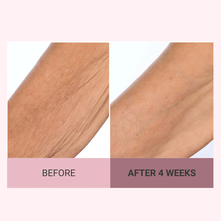 💆♀️ Experience Ultimate Luxury - 50% OFF - ✨ Champagne Beaute Lift Firming Body Cream - For Firmer, Smoother, Radiant Skin! 🌟(Buy 3 & Free Shipping)