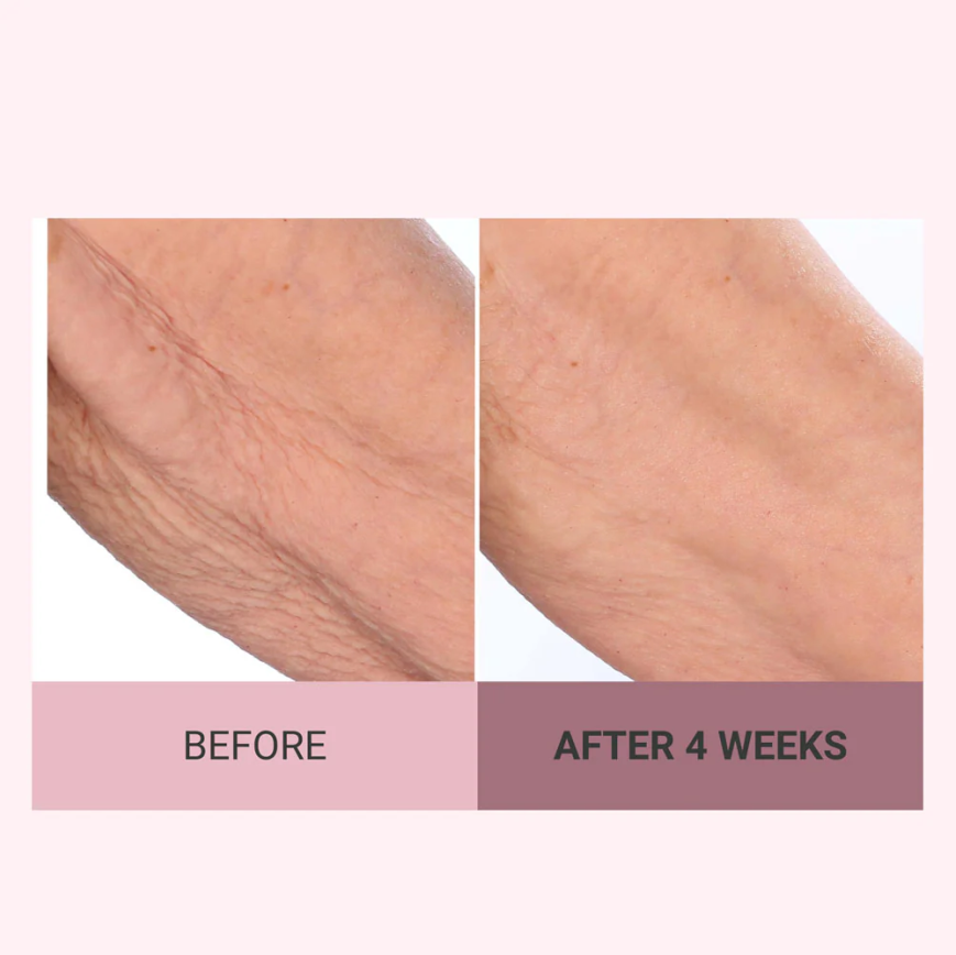 💆♀️ Experience Ultimate Luxury - 50% OFF - ✨ Champagne Beaute Lift Firming Body Cream - For Firmer, Smoother, Radiant Skin! 🌟(Buy 3 & Free Shipping)
