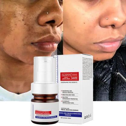 🔥FLASH SALE 50%：5-second brightening rescue: Dark spots disappear, blemishes fade, and skin becomes radiant! Vitamin C Whitening Freckles ESSENCE(3 HOURS LEFT!)