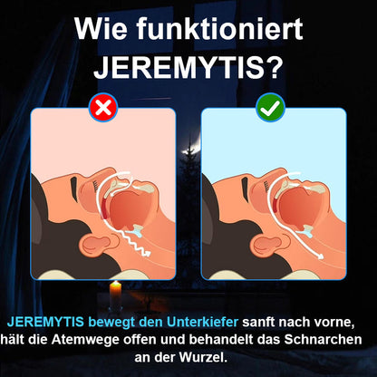 JEREMYTIS™ Adjustable Anti-Snoring Mouthpiece~